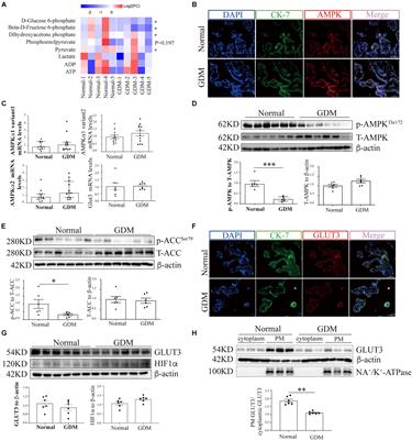 Gestational Diabetes Mellitus-Associated Hyperglycemia Impairs Glucose Transporter 3 Trafficking in Trophoblasts Through the Downregulation of AMP-Activated Protein Kinase